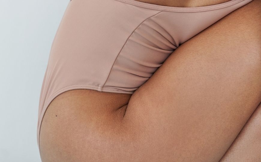 How to Fight Cellulite: 5 Natural Ways and 1 DIY Recipe